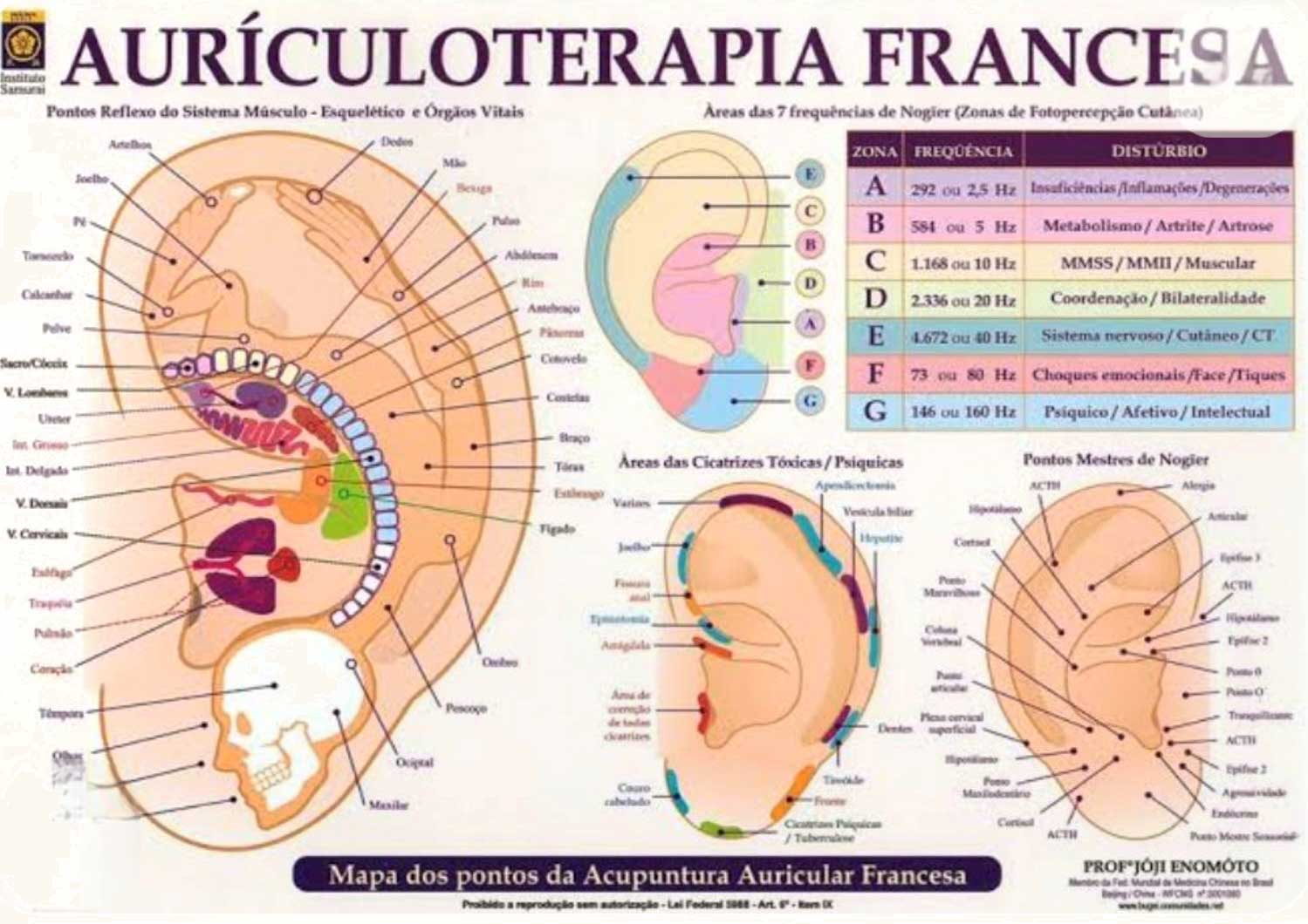 Auriculoterapia Francesa